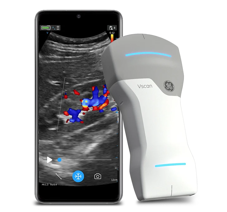 Vscanair with kidney image